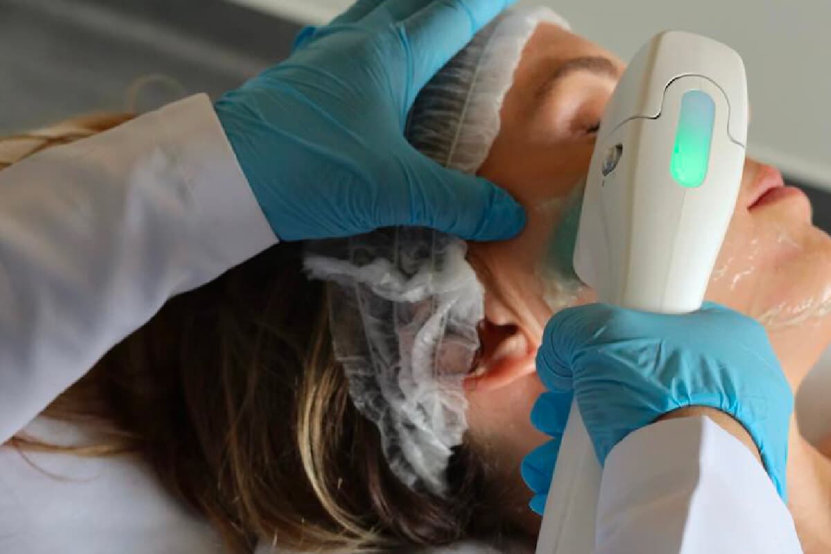 HIFU Facial: Resultados, Duração e Número de Sessões
