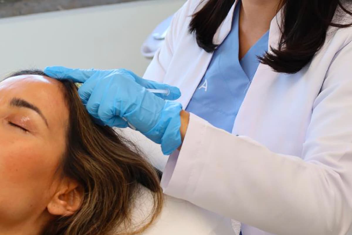 Mesoterapia Capilar: Como Funciona para a Queda de Cabelo