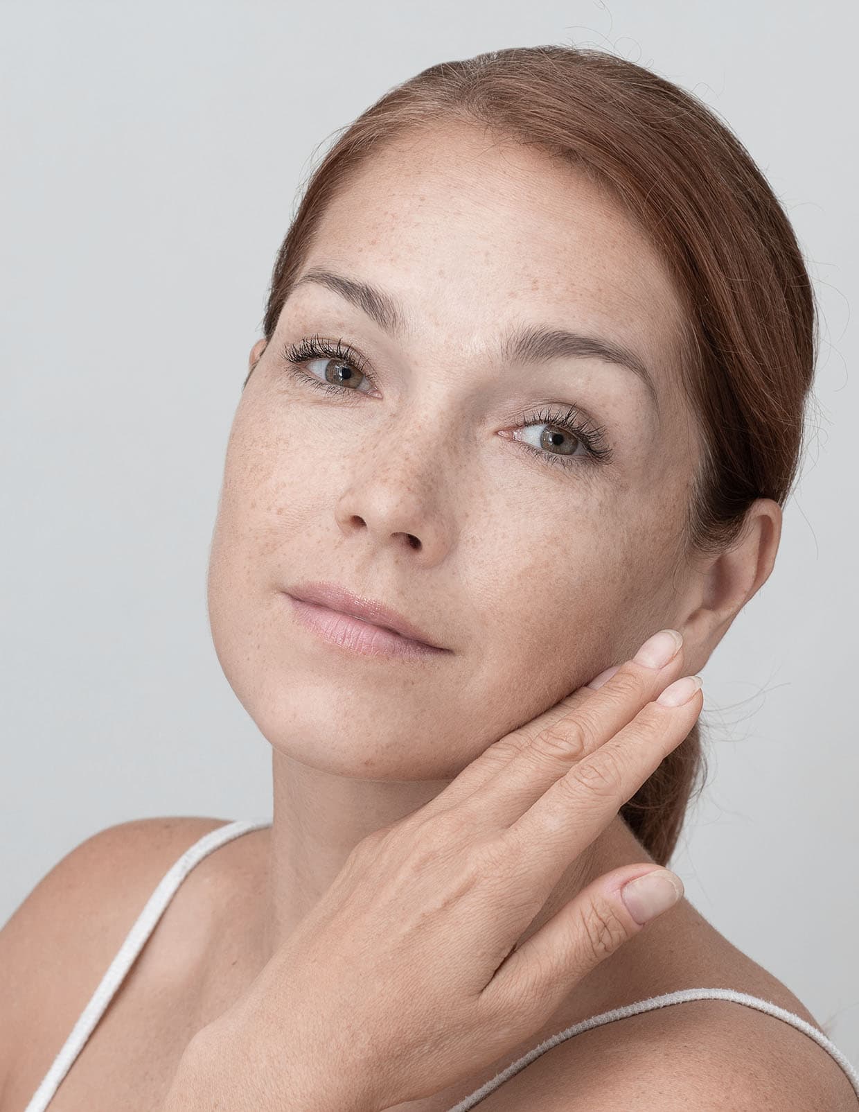 Região Zigomática / Maças do rosto | Estética