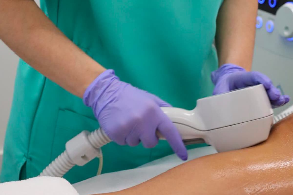 Exilis: Para Que Serve, Resultados e Quantas Sessões São Necessárias